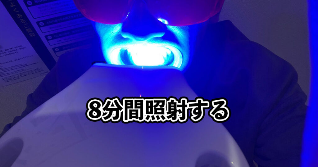 筆者が実際にセルフホワイトニングをしている